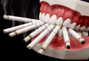 Вред зубам от курения