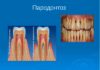 Пародонтоз: основные симптомы и лечение