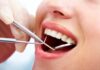 Виды лечения зубов