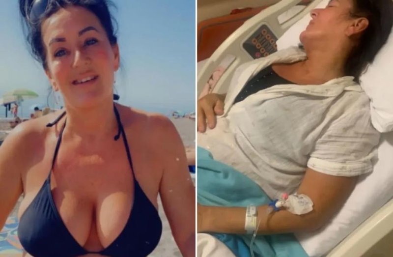 Туристка в ужасе: у нее вывалились импланты груди после операции в Турции